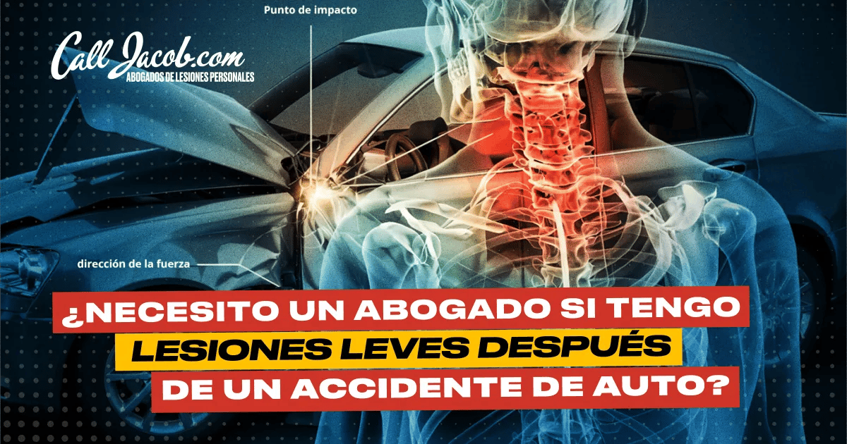 Abogado para lesiones leves tras un choque