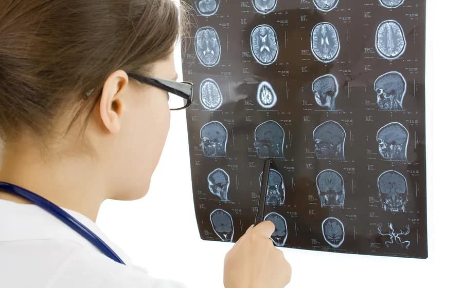 Traumatic Brain Injury Tbi Look