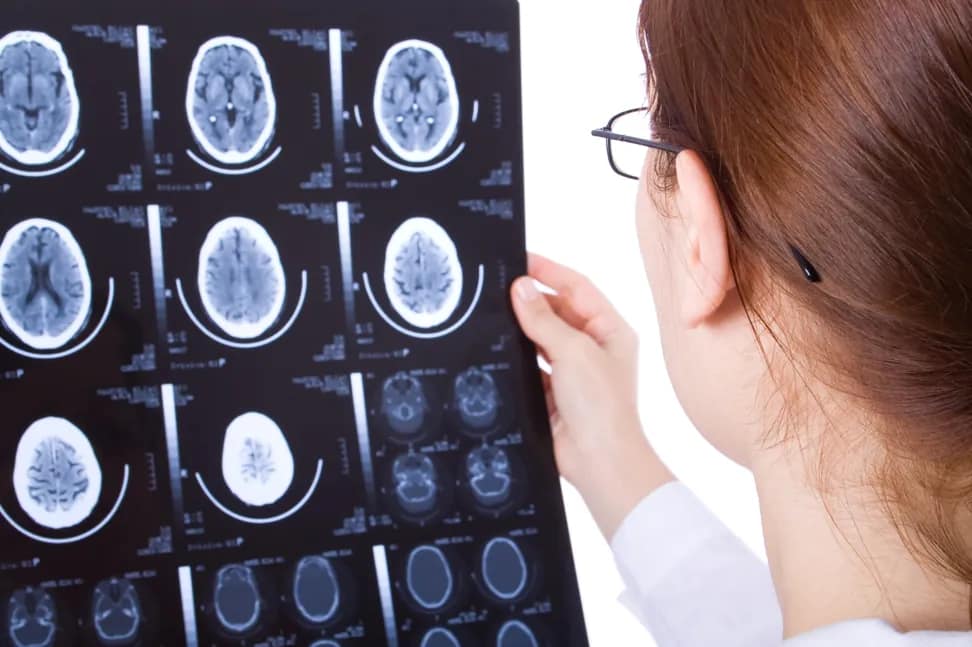 What Happens After a Traumatic Brain Injury
