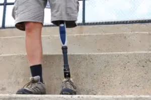 A person wearing khaki shorts and hiking shoes stands on concrete steps. One leg is natural, and the other is a prosthetic limb. A metal fence is visible in the background.